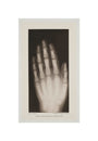 Hand of an 8 year-old girl, 1896. unstretched canvas small none Art Print - Science Museum Shop