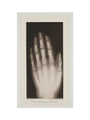 Hand of an 8 year-old girl, 1896. art print medium none Art Print - Science Museum Shop