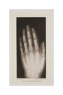Hand of an 8 year-old girl, 1896. unstretched canvas medium none Art Print - Science Museum Shop