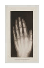 Hand of an 8 year-old girl, 1896. unstretched canvas large none Art Print - Science Museum Shop