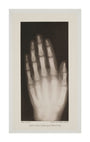 Hand of an 8 year-old girl, 1896. unstretched canvas extra large none Art Print - Science Museum Shop