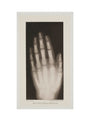 Hand of an 8 year-old girl, 1896. art print extra large none Art Print - Science Museum Shop